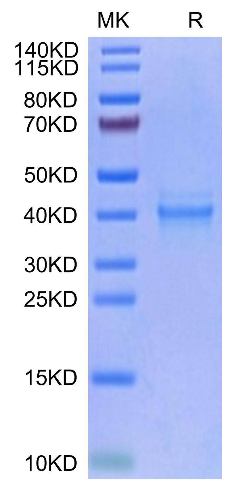 Human IL-12 on Tris-Bis PAGE under reduced condition. The purity is greater than 95%.Recombinant Human IL-12 Protein, Active