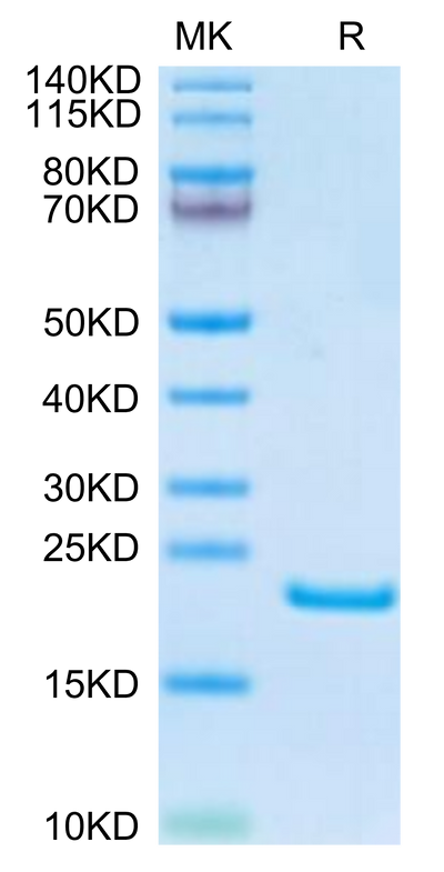 Human AGR-2 on Tris-Bis PAGE under reduced condition. The purity is greater than 95%.Recombinant Human AGR-2 Protein, Active