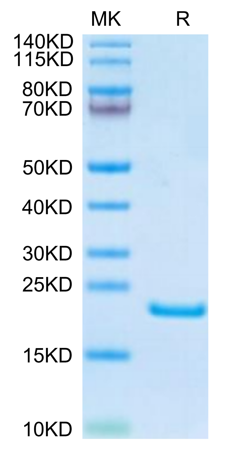 Human AGR-2 on Tris-Bis PAGE under reduced condition. The purity is greater than 95%.Recombinant Human AGR-2 Protein, Active