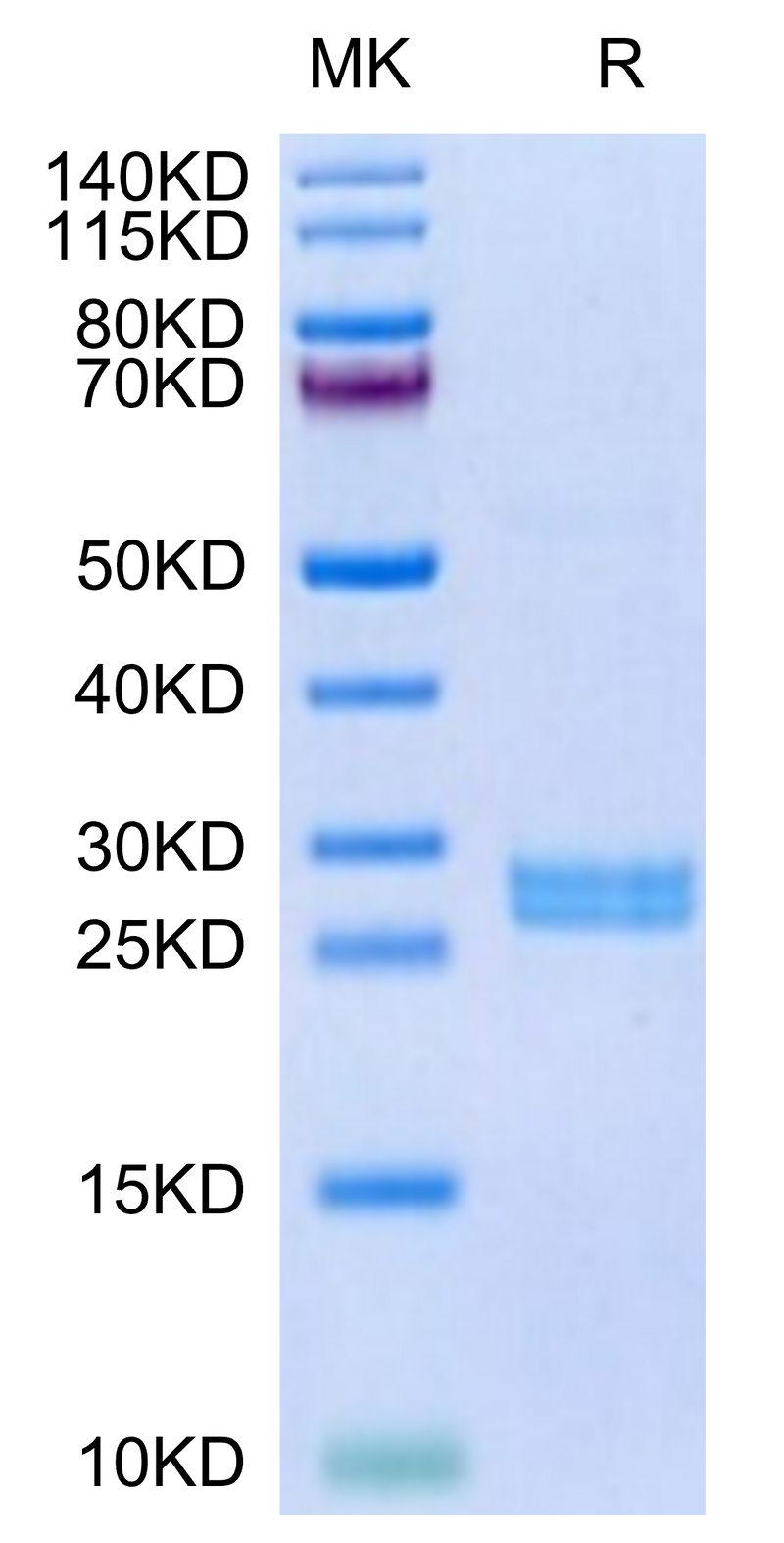 Mouse Hepcidin on Tris-Bis PAGE under reduced condition. The purity is greater than 95%.Recombinant Mouse Hepcidin/HAMP Protein