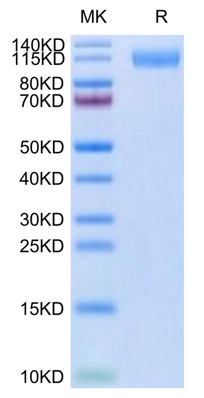 SARS-COV-2 Spike S1 (B.1.640.2/IHU) on Tris-Bis PAGE under reduced condition. The purity is greater than 95%.Recombinant SARS-COV-2 Spike S1 (B.1.640.2/IHU) Protein, Active