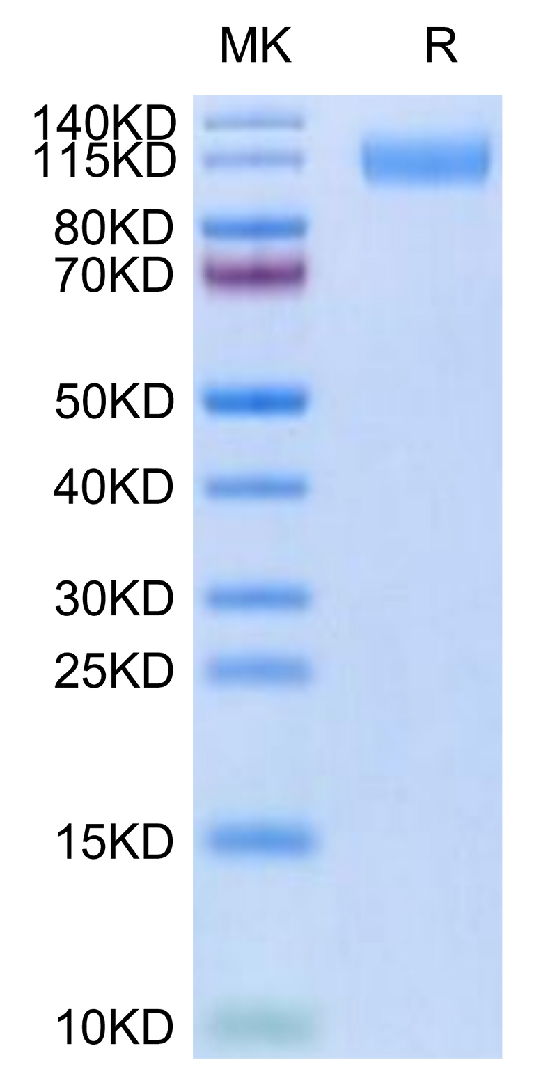 SARS-COV-2 Spike S1 (B.1.640.2/IHU) on Tris-Bis PAGE under reduced condition. The purity is greater than 95%.Recombinant SARS-COV-2 Spike S1 (B.1.640.2/IHU) Protein, Active