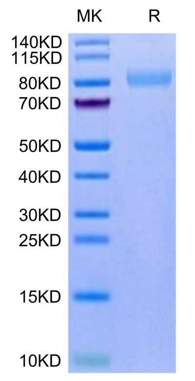 Mouse LRRN1 on Tris-Bis PAGE under reduced condition. The purity is greater than 95%.Recombinant Mouse LRRN1 Protein