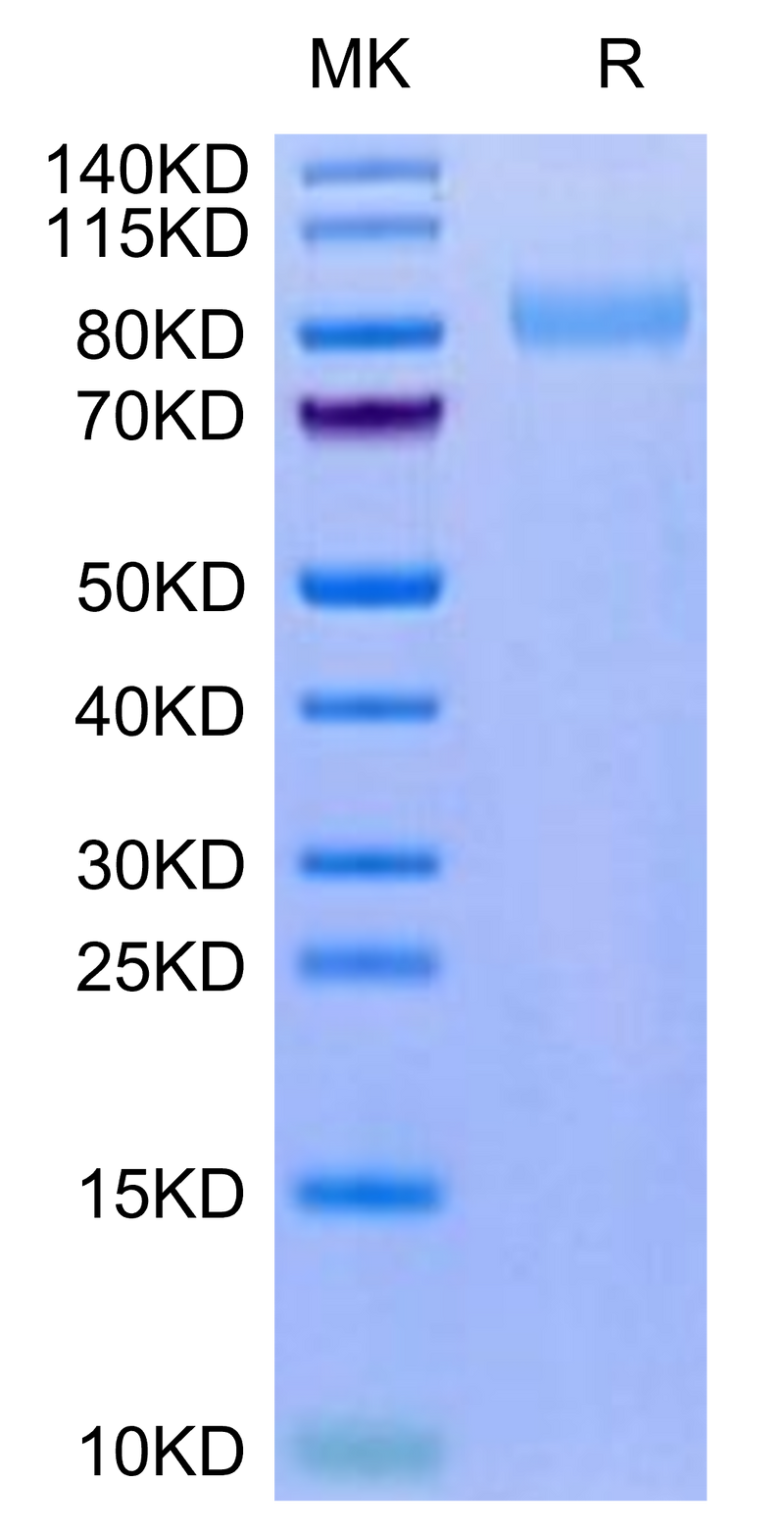 Mouse LRRN1 on Tris-Bis PAGE under reduced condition. The purity is greater than 95%.Recombinant Mouse LRRN1 Protein