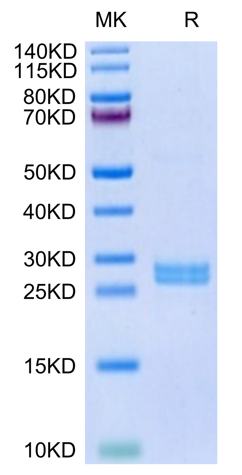 Human Hepcidin on Tris-Bis PAGE under reduced condition. The purity is greater than 95%.Recombinant Human Hepcidin/HAMP Protein