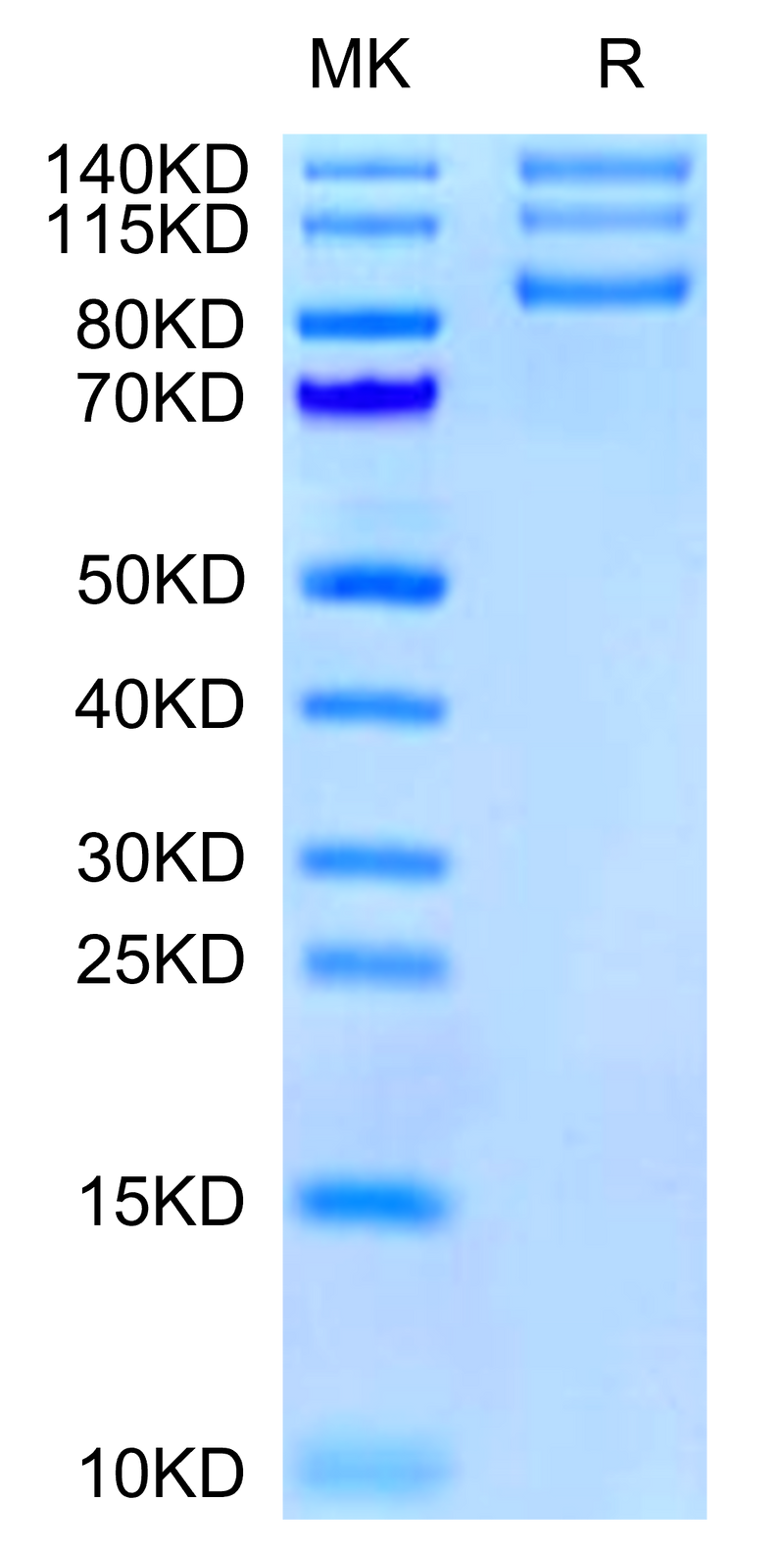 Human ITGAV&ITGB8 on Tris-Bis PAGE under reduced condition. The purity is greater than 95%.Recombinant Human Integrin alpha V beta 8 (ITGAV&ITGB8) Heterodimer Protein, Active