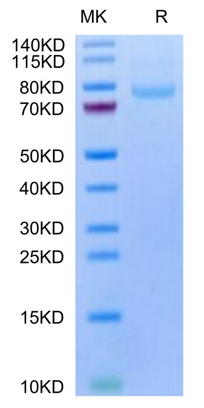 Human LRRC15 on Tris-Bis PAGE under reduced condition. The purity is greater than 95%.Recombinant Human LRRC15/LIB Protein, Active
