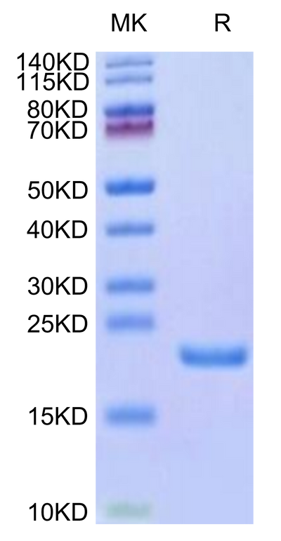 Mouse AGR-2 on Tris-Bis PAGE under reduced condition. The purity is greater than 95%.Recombinant Mouse AGR-2 Protein