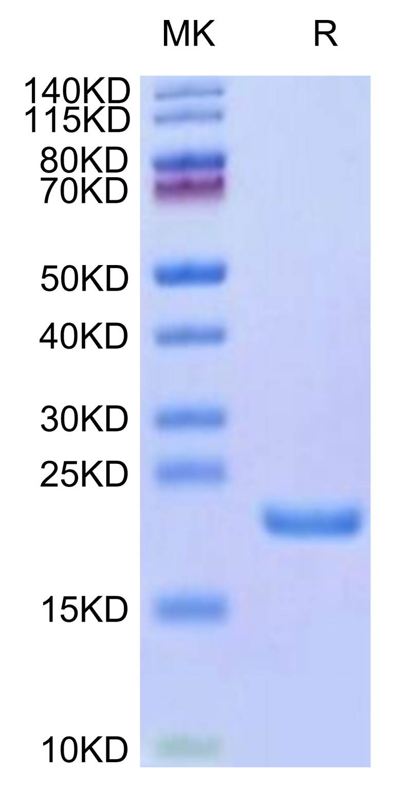 Mouse AGR-2 on Tris-Bis PAGE under reduced condition. The purity is greater than 95%.Recombinant Mouse AGR-2 Protein
