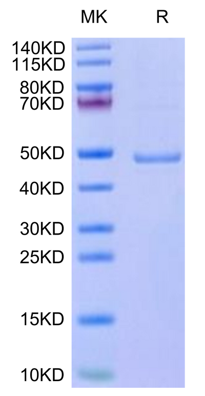 Mouse Leptin on Tris-Bis PAGE under reduced condition. The purity is greater than 95%.Recombinant Mouse Leptin Protein