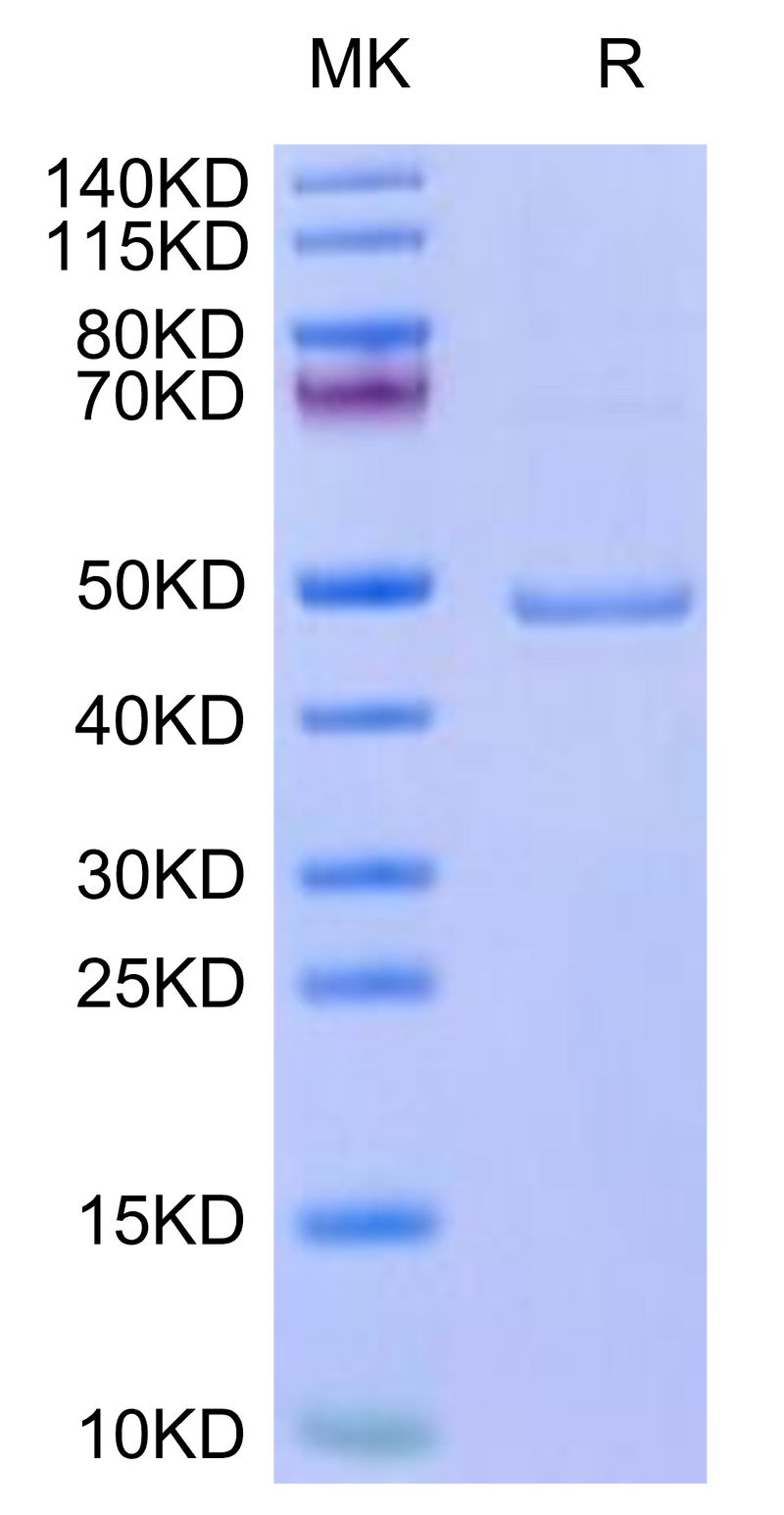 Mouse Leptin on Tris-Bis PAGE under reduced condition. The purity is greater than 95%.Recombinant Mouse Leptin Protein