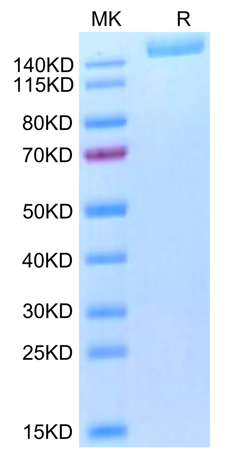 Biotinylated SARS-COV-2 Spike S (Omicron B.1.1.529) Trimer on Tris-Bis PAGE under reduced condition. The purity is greater than 95%.Biotinylated SARS-COV-2 Spike S (Omicron B.1.1.529) Trimer Protein, Active