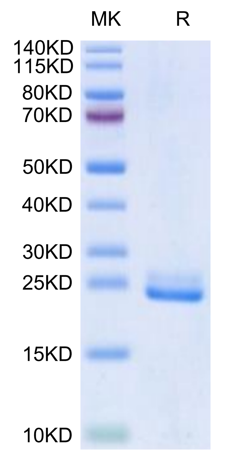 Human DLL3 (27-215) on Tris-Bis PAGE under reduced condition. The purity is greater than 95%.Recombinant Human DLL3 (27-215) Protein, Active