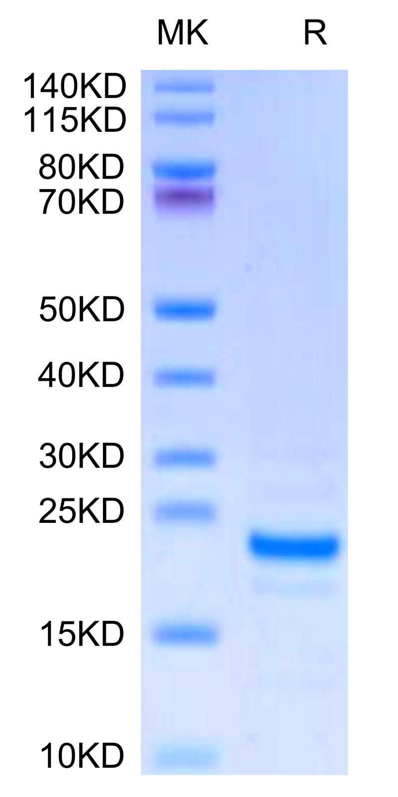 Mouse Midkine on Tris-Bis PAGE under reduced condition. The purity is greater than 95%.Recombinant Mouse Midkine Protein