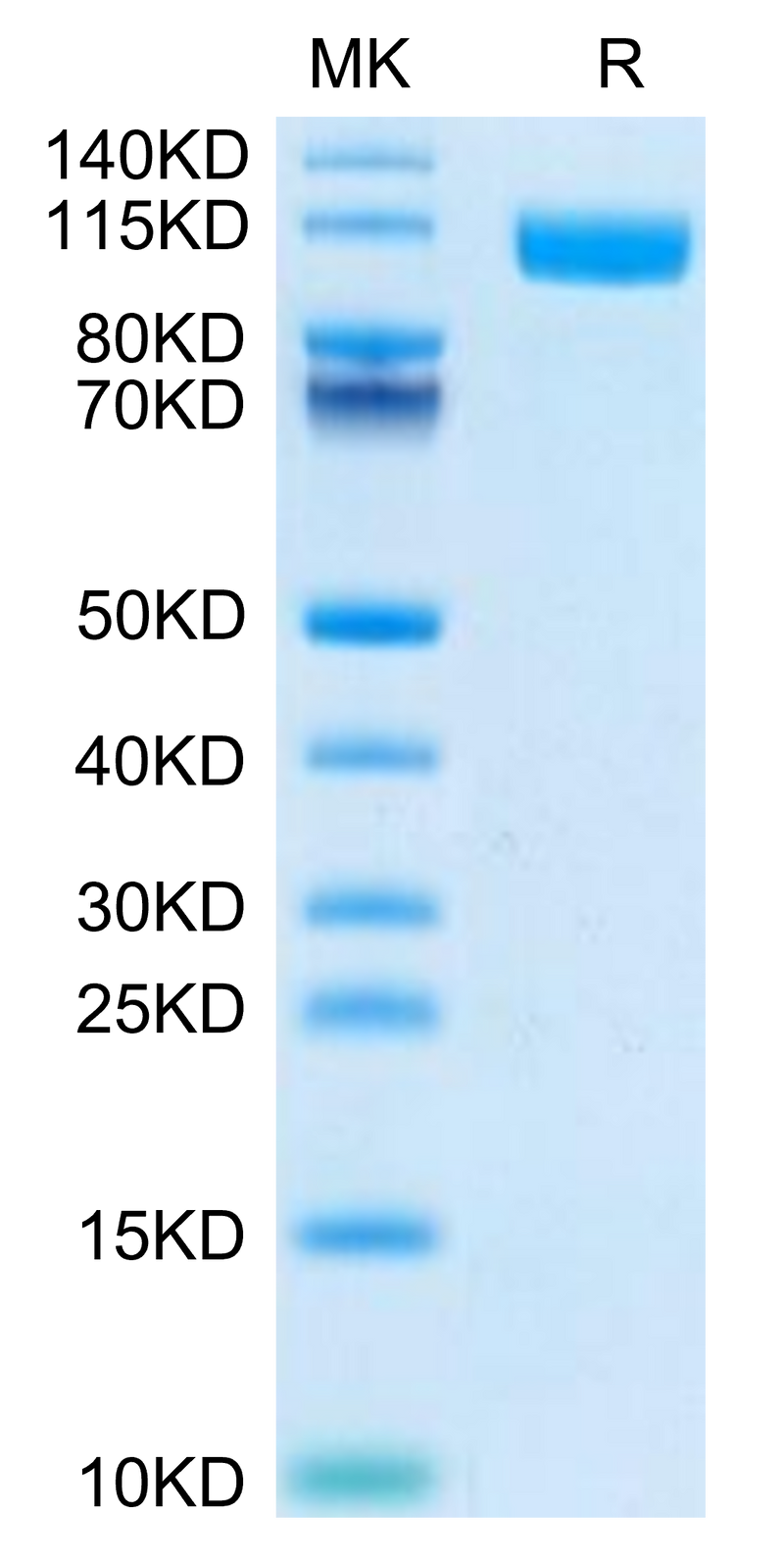 Biotinylated Human TLR3 on Tris-Bis PAGE under reduced condition. The purity is greater than 95%.Biotinylated Human TLR3 Protein (Primary Amine Labeling), Active