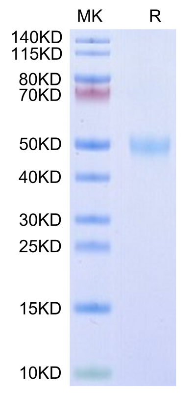 Human/Cynomolgus/Rhesus macaque ROR1 (30-305,Ig-like&Frizzled Domain) on Tris-Bis PAGE under reduced condition. The purity is greater than 95%.Recombinant Human/Cynomolgus/Rhesus macaque ROR1 (30-305,Ig-like&Frizzled Domain) Protein, Active