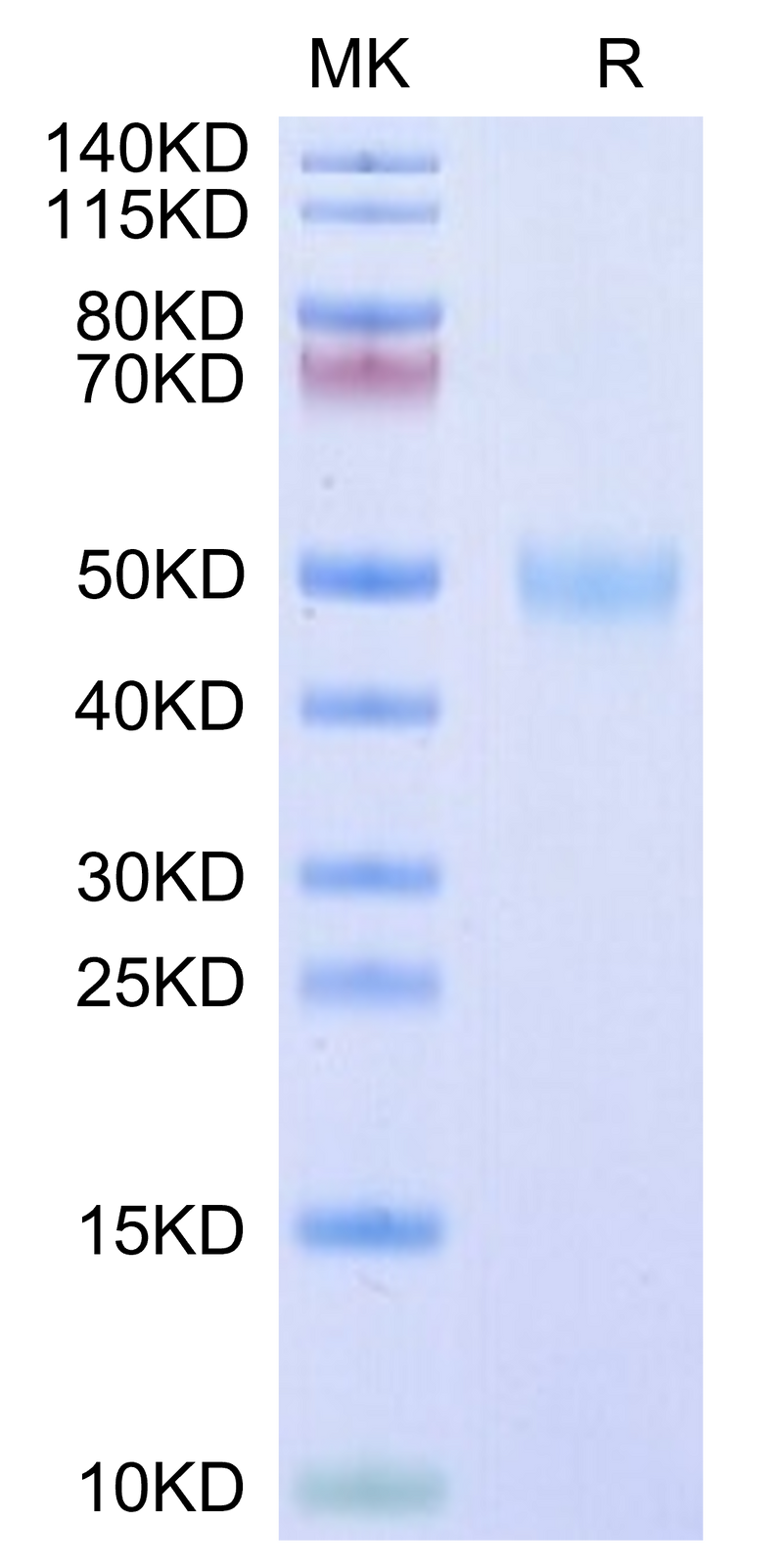 Human/Cynomolgus/Rhesus macaque ROR1 (30-305,Ig-like&Frizzled Domain) on Tris-Bis PAGE under reduced condition. The purity is greater than 95%.Recombinant Human/Cynomolgus/Rhesus macaque ROR1 (30-305,Ig-like&Frizzled Domain) Protein, Active
