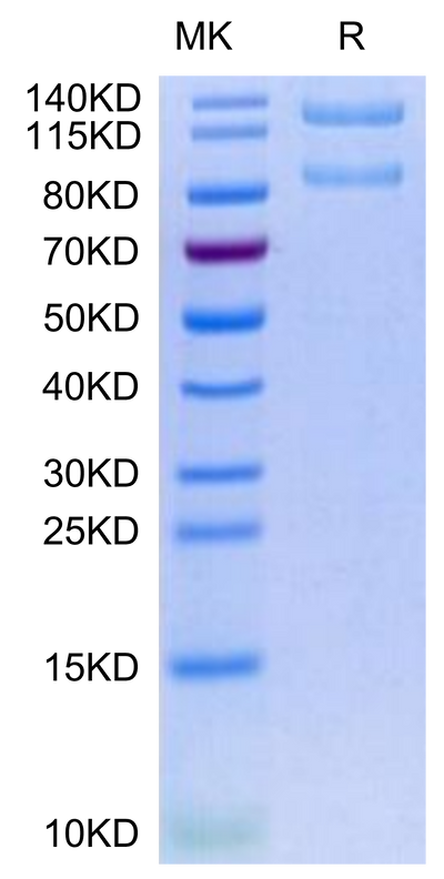 Human ITGAX&ITGB2 on Tris-Bis PAGE under reduced condition. The purity is greater than 95%.Recombinant Human Integrin alpha X beta 2 (ITGAX&ITGB2) Heterodimer Protein, Active