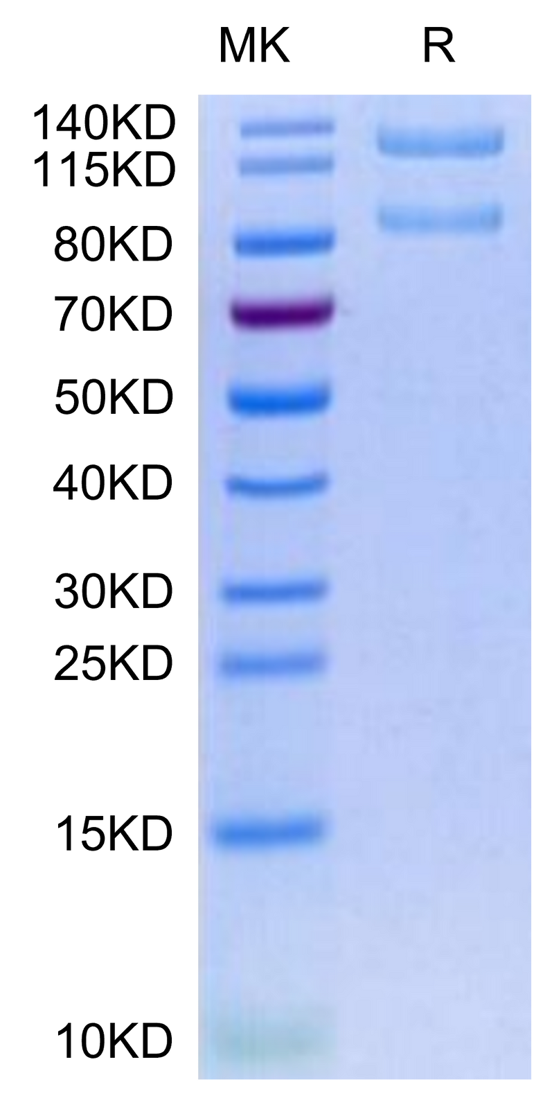 Human ITGAX&ITGB2 on Tris-Bis PAGE under reduced condition. The purity is greater than 95%.Recombinant Human Integrin alpha X beta 2 (ITGAX&ITGB2) Heterodimer Protein, Active