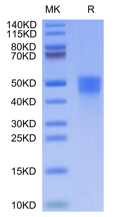 Cynomolgus M-CSF on Tris-Bis PAGE under reduced condition. The purity is greater than 95%.Recombinant Cynomolgus M-CSF/CSF-1 Protein, Active