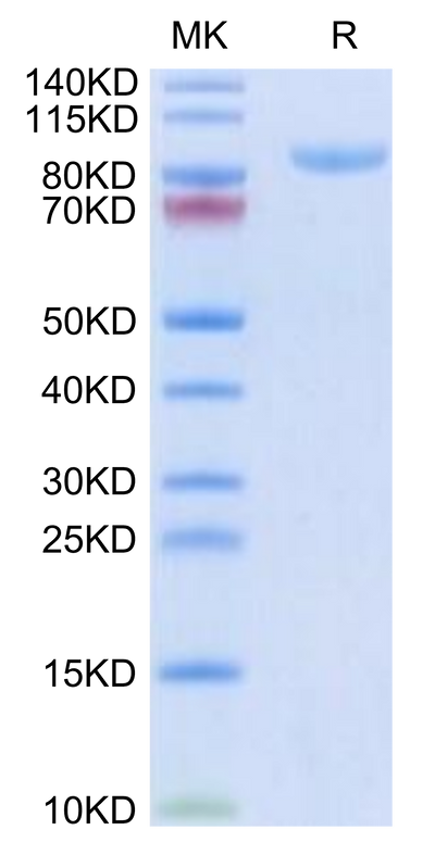 Human APLP2 on Tris-Bis PAGE under reduced condition. The purity is greater than 95%.Recombinant Human APLP2 Protein