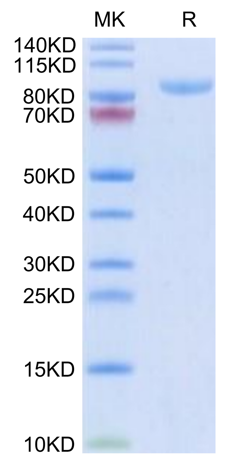 Human APLP2 on Tris-Bis PAGE under reduced condition. The purity is greater than 95%.Recombinant Human APLP2 Protein