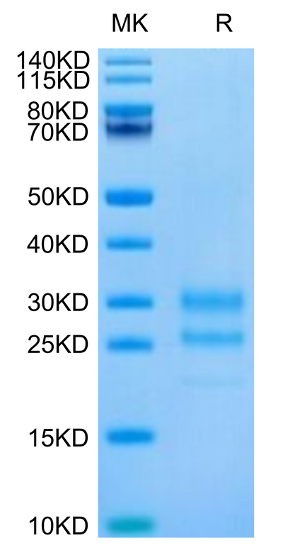 Cynomolgus IL-17A on Tris-Bis PAGE under reduced condition. The purity is greater than 95%.Recombinant Cynomolgus IL-17A/CTLA-8 Protein, Active
