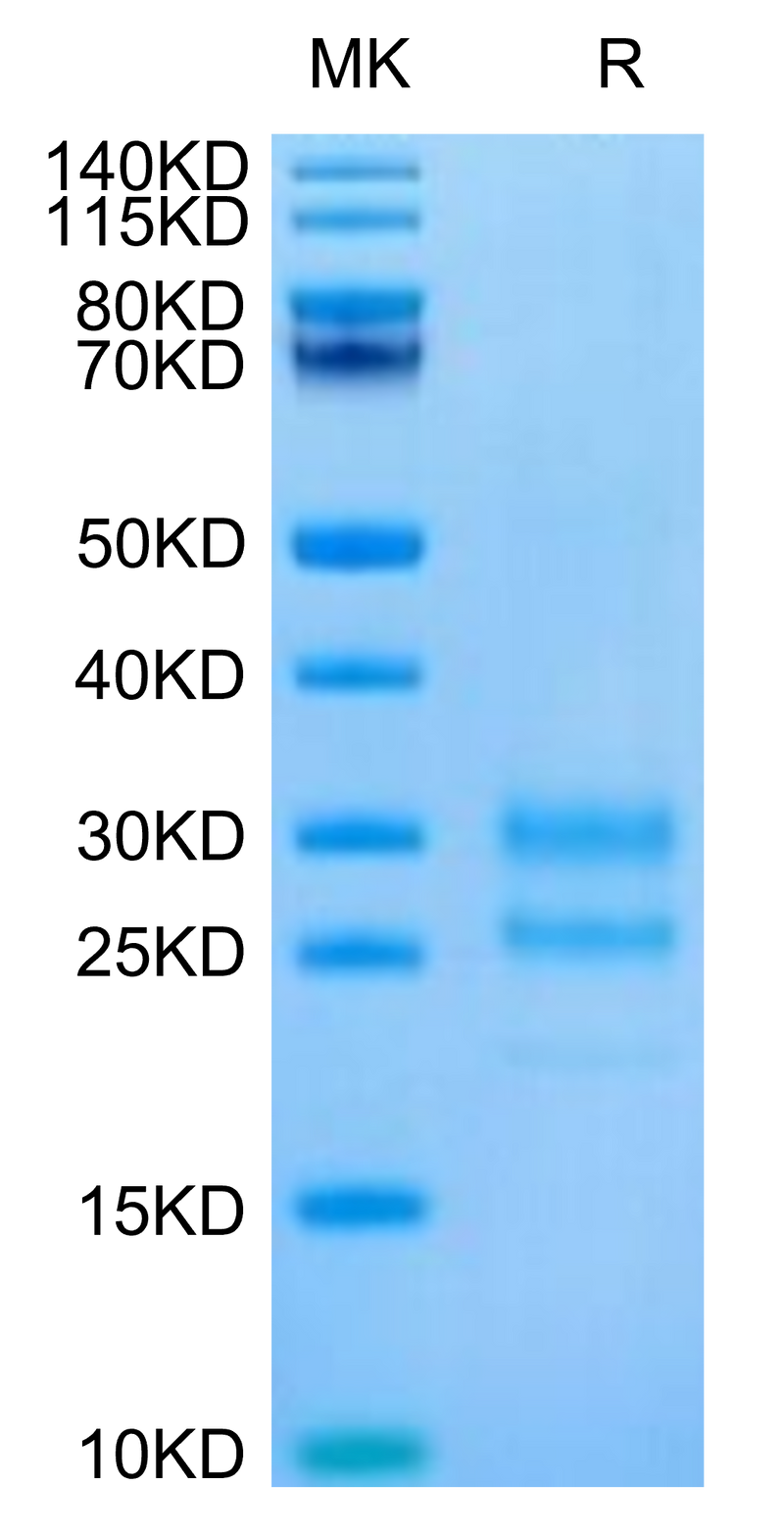Cynomolgus IL-17A on Tris-Bis PAGE under reduced condition. The purity is greater than 95%.Recombinant Cynomolgus IL-17A/CTLA-8 Protein, Active