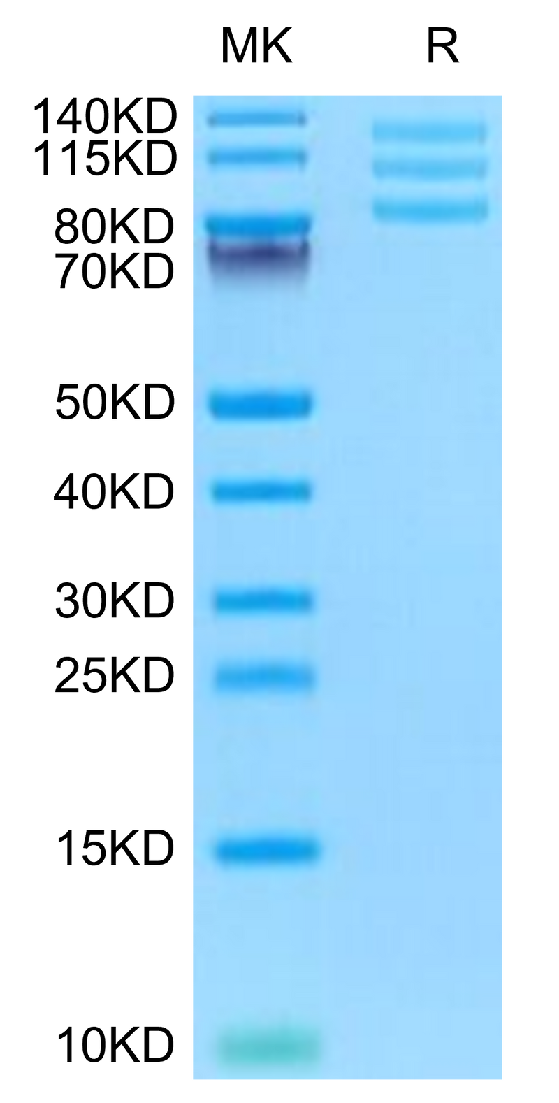Mouse ITGAV&ITGB8 on Tris-Bis PAGE under reduced condition. The purity is greater than 95%.Recombinant Mouse Integrin alpha V beta 8 (ITGAV&ITGB8) Heterodimer Protein, Active