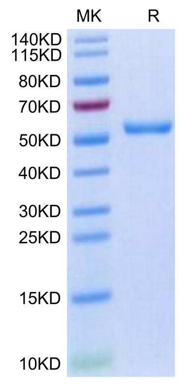 Human HLA-A*02:01&B2M&HPV16 E7 (YMLDLQPET) Monomer on Tris-Bis PAGE under reduced condition. The purity is greater than 95%.Recombinant Human HLA-A*02:01&B2M&HPV16 E7 (YMLDLQPET) Monomer Protein