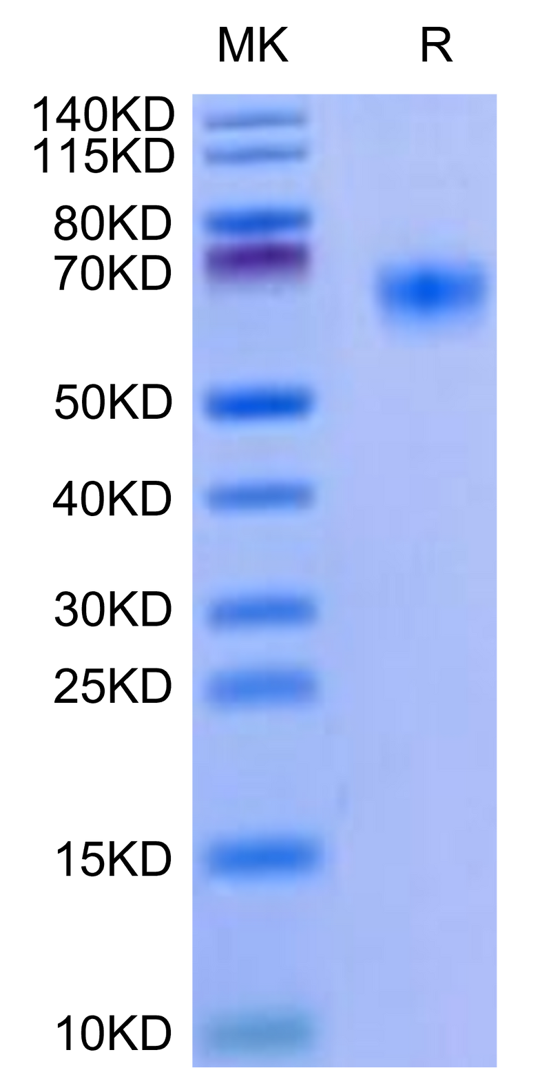 Mouse BACE-1 on Tris-Bis PAGE under reduced condition. The purity is greater than 95%.Recombinant Mouse BACE-1 Protein