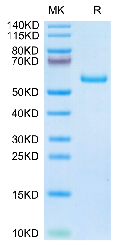 Human TIMP1 on Tris-Bis PAGE under reduced condition. The purity is greater than 95%.Recombinant Human TIMP1 Protein