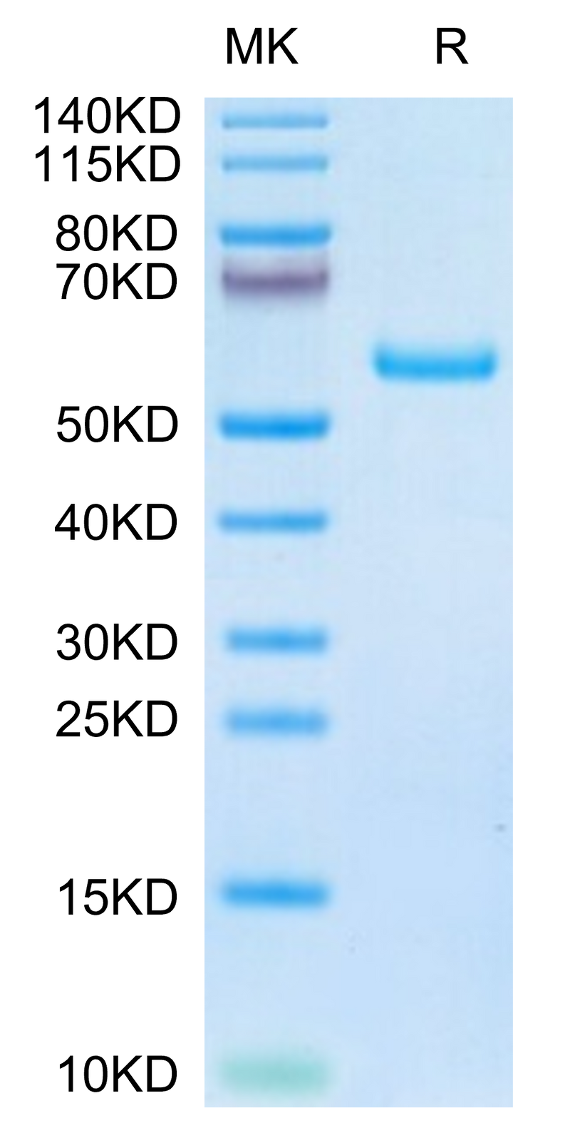 Human TIMP1 on Tris-Bis PAGE under reduced condition. The purity is greater than 95%.Recombinant Human TIMP1 Protein