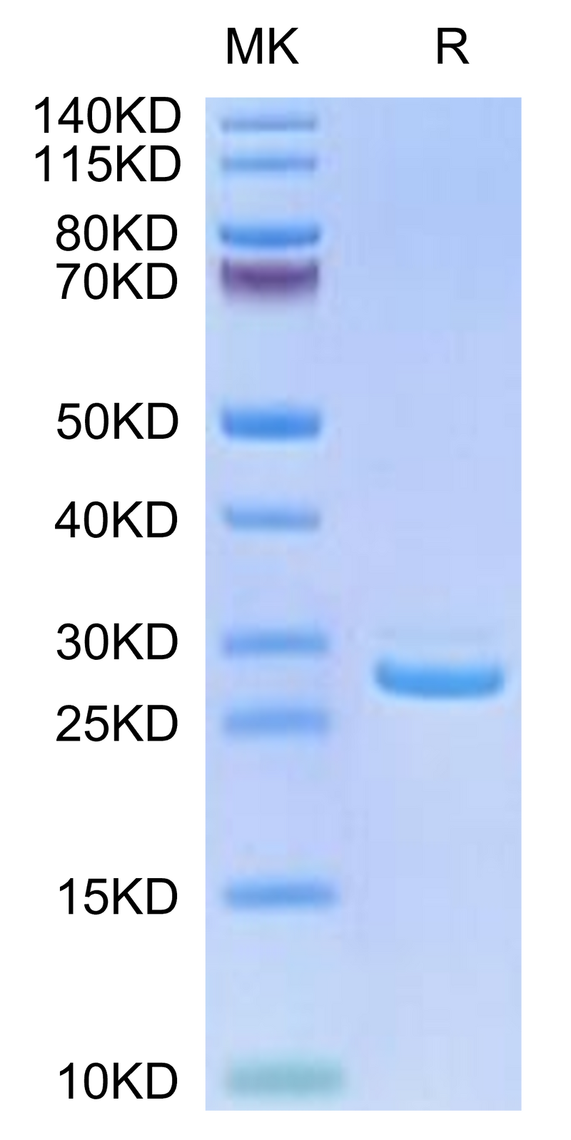 Human LILRB1 Domain1&2 on Tris-Bis PAGE under reduced conditions. The purity is greater than 95%.Recombinant Human LILRB1/CD85j/ILT2 Domain1&2-Protein, Active