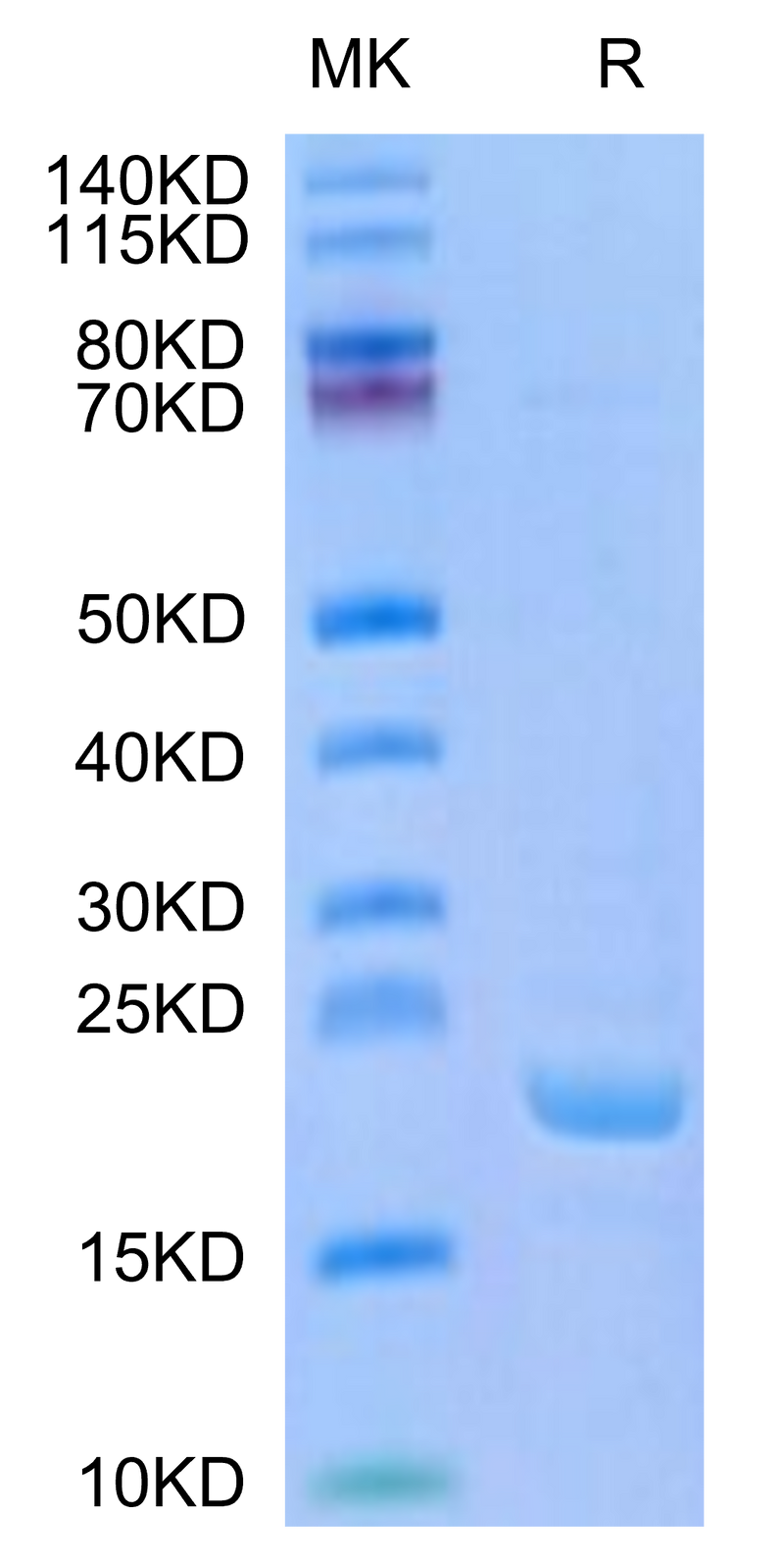 Human BPIFA1 on Tris-Bis PAGE under reduced condition. The purity is greater than 95%.Recombinant Human BPIFA1/LUNX Protein