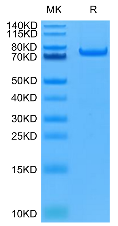 Human PADI4 on Tris-Bis PAGE under reduced condition. The purity is greater than 95%.Recombinant Human PADI4 Protein