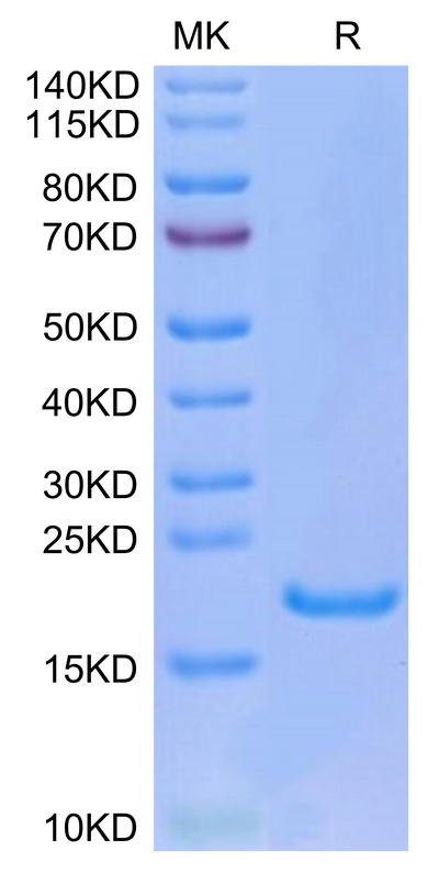Human IL-33 on Tris-Bis PAGE under reduced condition. The purity is greater than 95%.Recombinant Human IL-33 Protein, Active