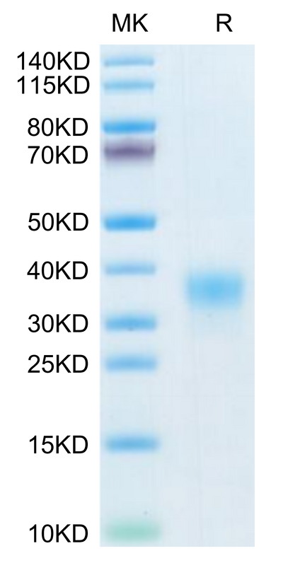 Human AMHRII on Tris-Bis PAGE under reduced condition. The purity is greater than 95%.Recombinant Human AMHRII Protein, Active