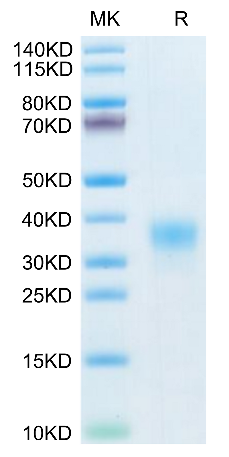 Human AMHRII on Tris-Bis PAGE under reduced condition. The purity is greater than 95%.Recombinant Human AMHRII Protein, Active