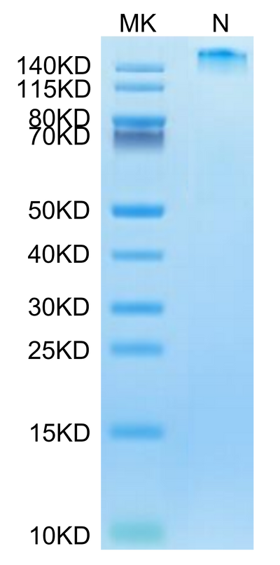 Human HLA-A*02:01&B2M&HBV (FLLTRILTI) Tetramer on Tris-Bis PAGE under reduced condition. The purity is greater than 95%.Recombinant Human HLA-A*02:01&B2M&HBV (FLLTRILTI) Tetramer Protein