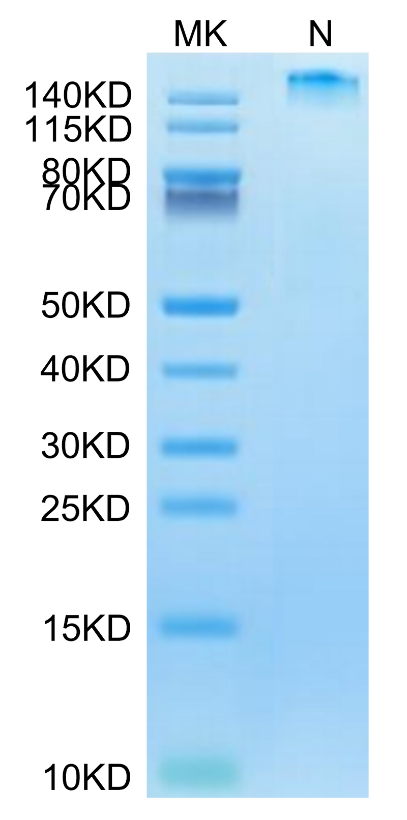 Human HLA-A*02:01&B2M&HBV (FLLTRILTI) Tetramer on Tris-Bis PAGE under reduced condition. The purity is greater than 95%.Recombinant Human HLA-A*02:01&B2M&HBV (FLLTRILTI) Tetramer Protein