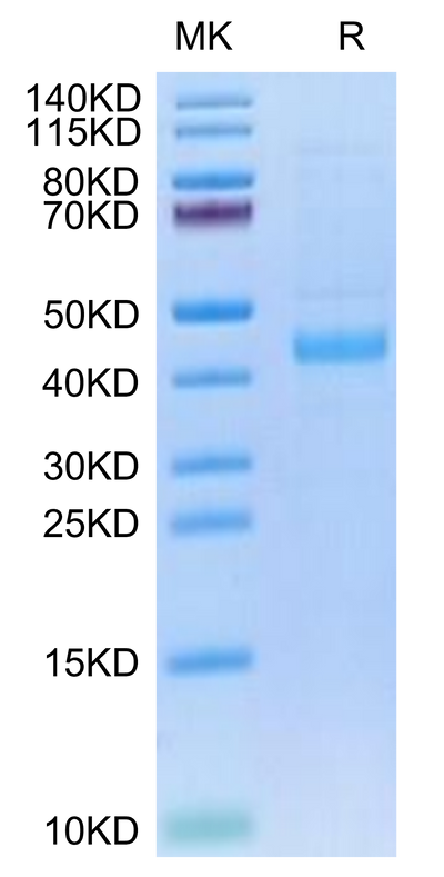 Human SFRP1 on Tris-Bis PAGE under reduced condition. The purity is greater than 95%.Recombinant Human SFRP1/SARP2 Protein