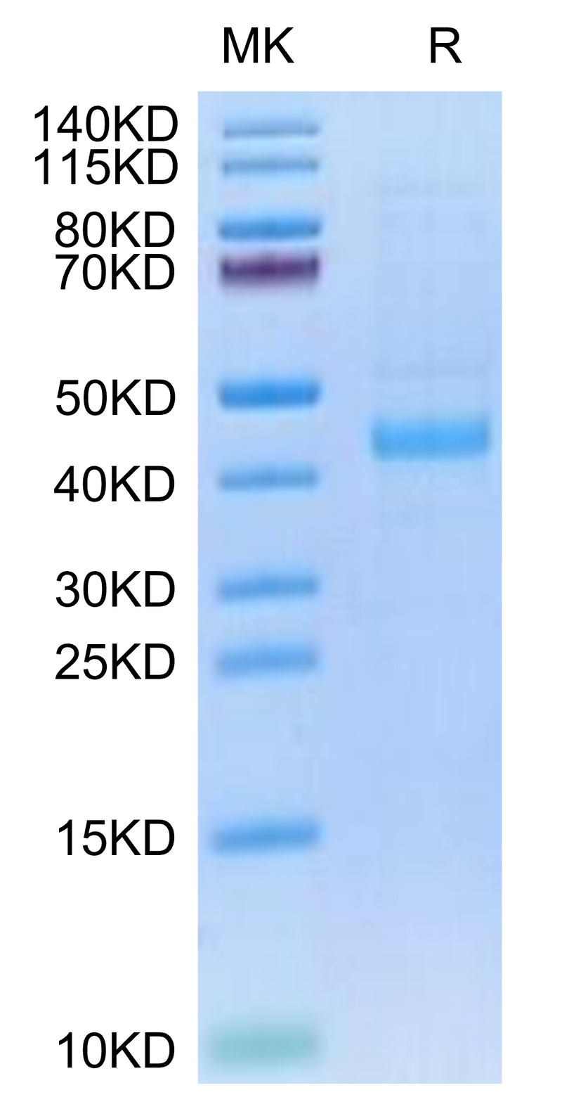Human SFRP1 on Tris-Bis PAGE under reduced condition. The purity is greater than 95%.Recombinant Human SFRP1/SARP2 Protein