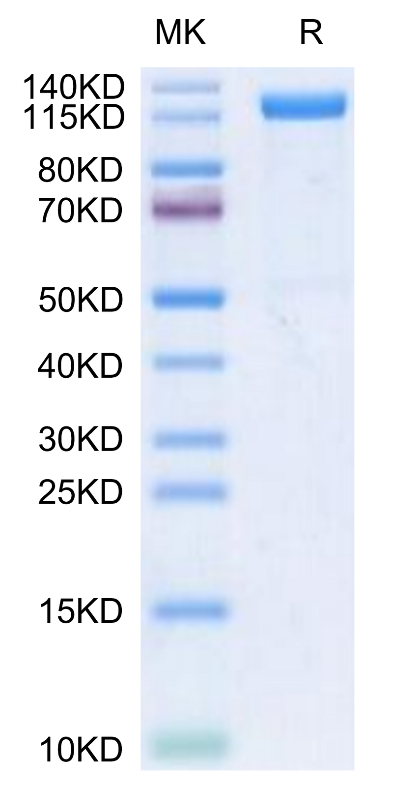 Human Beta Klotho on Tris-Bis PAGE under reduced conditions. The purity is greater than 95%.Recombinant Human Beta Klotho Protein, Active
