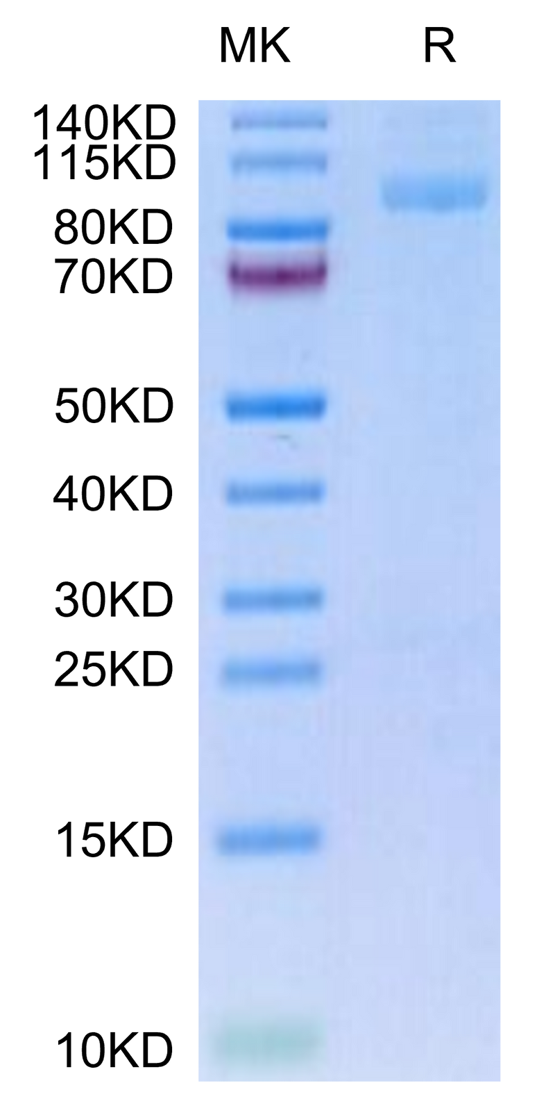 Mouse ITGA2B&ITGB3 on Tris-Bis PAGE under reduced condition. The purity is greater than 95%.Recombinant Mouse Integrin alpha 2B beta 3 (ITGA2B&ITGB3) Heterodimer Protein