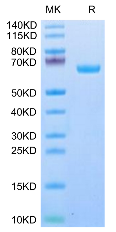 Human IL-22R alpha 1 on Tris-Bis PAGE under reduced condition. The purity is greater than 95%.Recombinant Human IL-22R alpha 1 Protein, Active