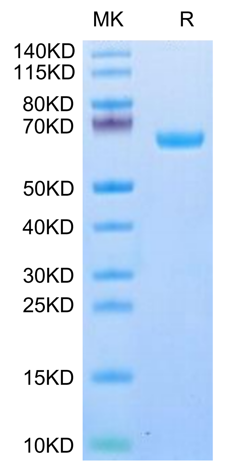 Human IL-22R alpha 1 on Tris-Bis PAGE under reduced condition. The purity is greater than 95%.Recombinant Human IL-22R alpha 1 Protein, Active