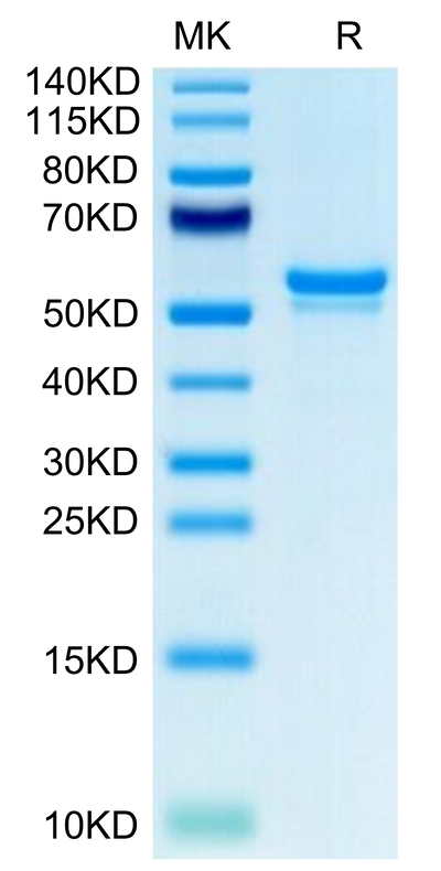 Human CA9 on Tris-Bis PAGE under reduced condition. The purity is greater than 95%.Recombinant Human CA9/Carbonic Anhydrase IX Protein, Active