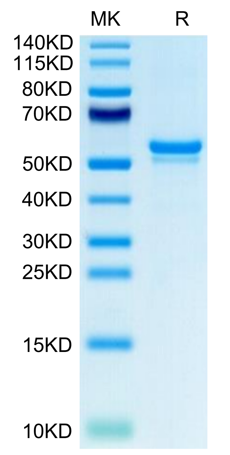 Human CA9 on Tris-Bis PAGE under reduced condition. The purity is greater than 95%.Recombinant Human CA9/Carbonic Anhydrase IX Protein, Active