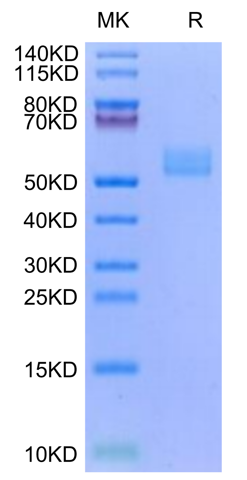 Human ICOS (Q50A) on Tris-Bis PAGE under reduced condition. The purity is greater than 95%.Recombinant Human ICOS/CD278 (Q50A) Protein, Active